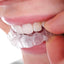 Avslappningsskena / Skyddsskena för tänder
